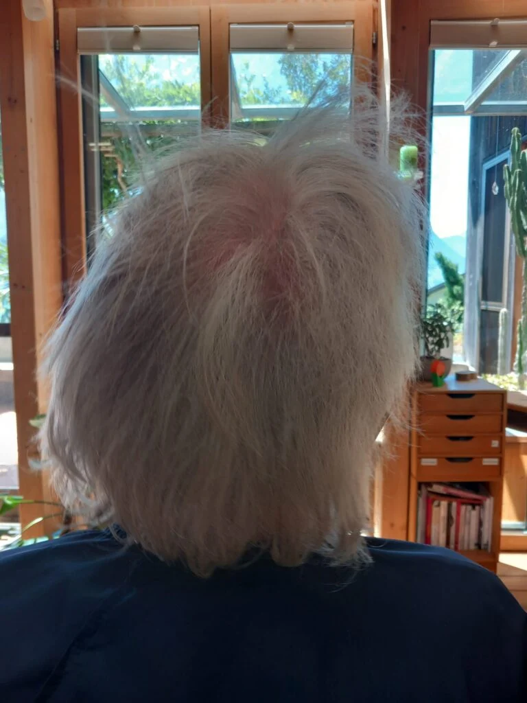 Vor dem Hairbalancing – J. L.