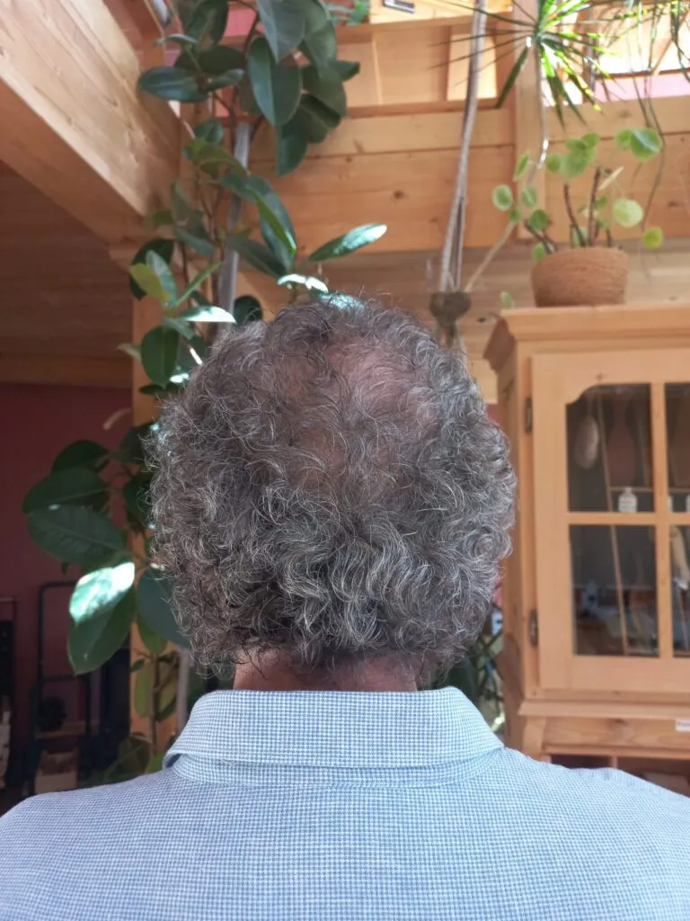 Nach dem Hairbalancing – M. A.