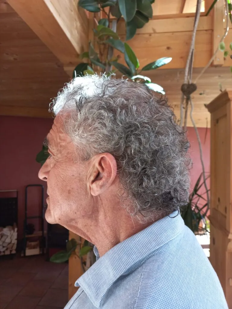 Nach dem Hairbalancing – M. A.